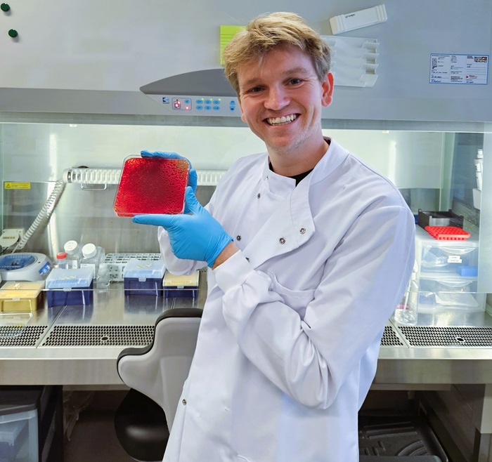 Philip Tinggaard Thomsen who is first author of the publication together with Samir Meramo