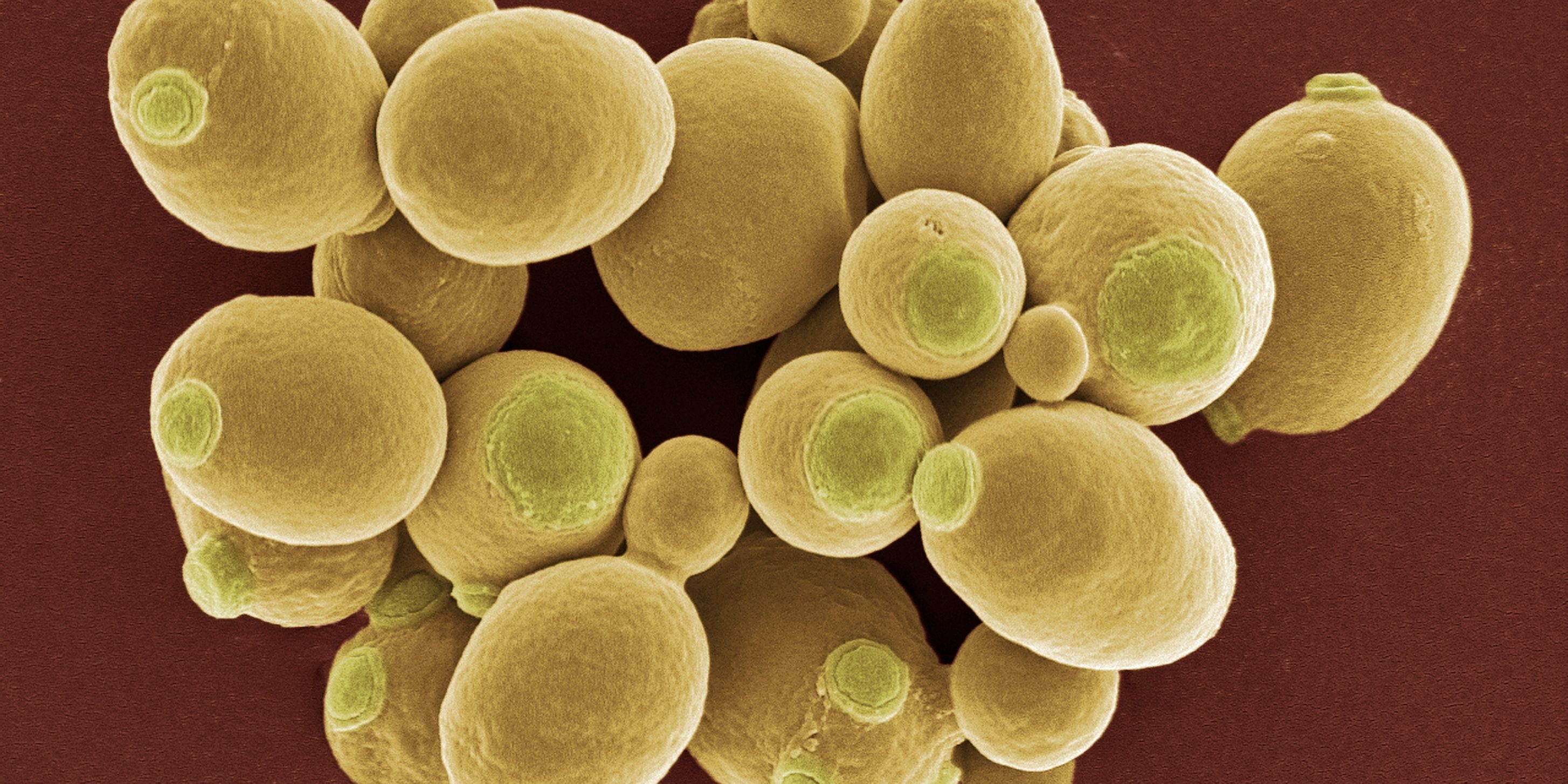 Yeast Metabolic Engineering
